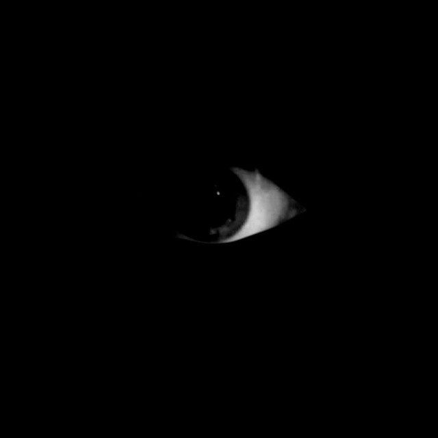 eye